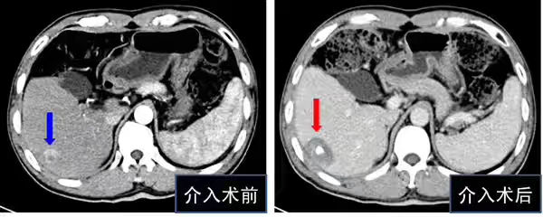 圖片 3.png 圖片 3.png