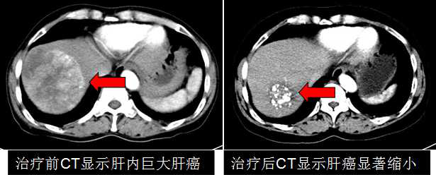 圖片 4.png 圖片 4.png