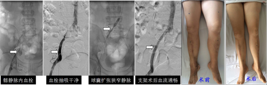 圖片 1_2.png 圖片 1_2.png