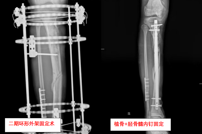 640 (1).png 640 (1).png